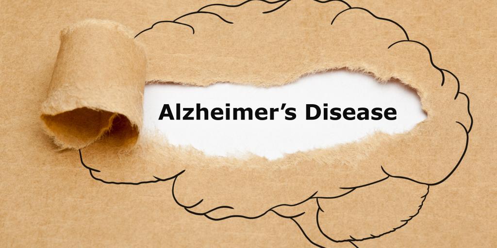 Alzheimer article